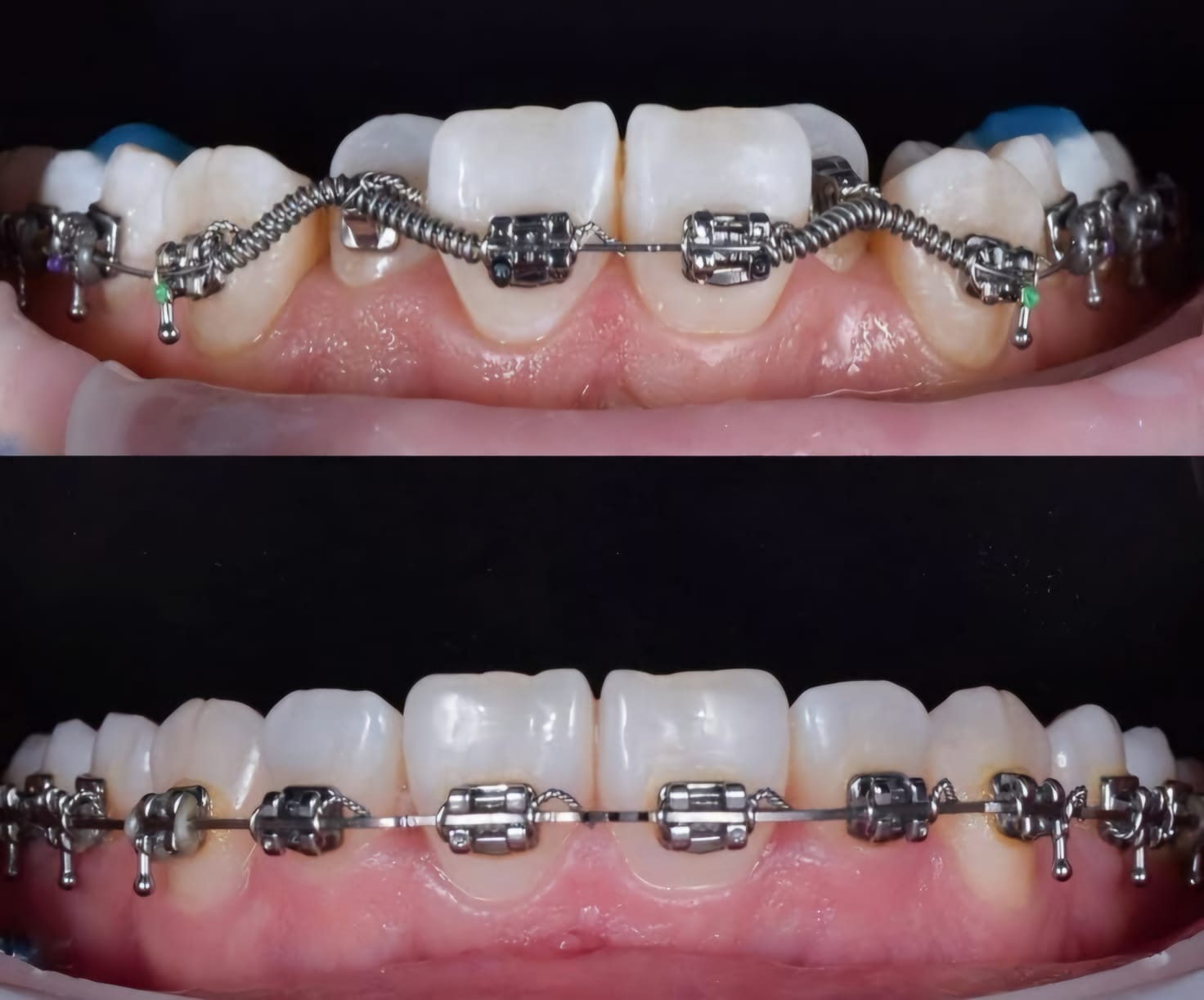 Orthodontie