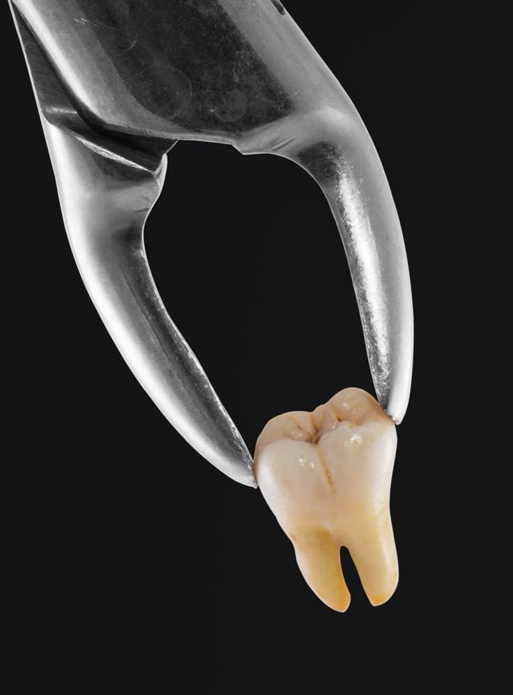 Soins dentaires